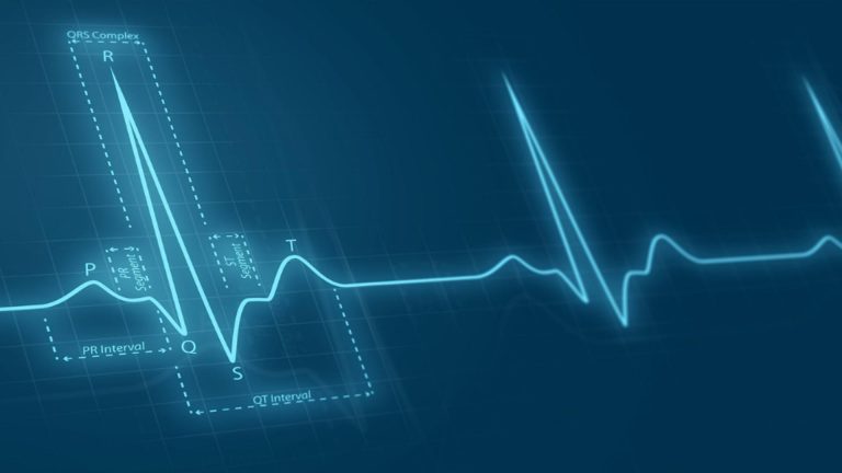 De ce apar aritmiile cardiace si ce recomanda medicii